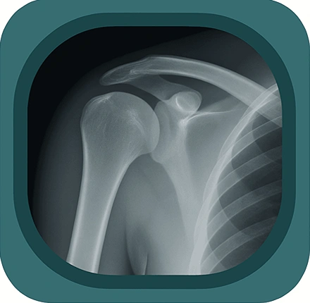 X ray  shoulder anatomy icon
